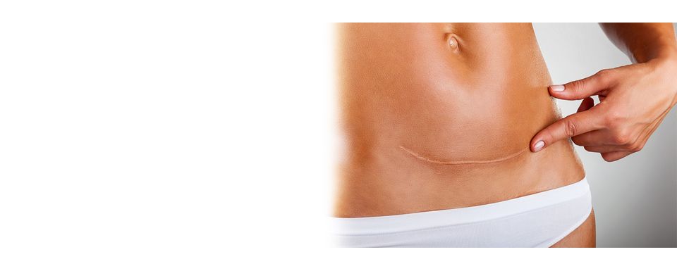 Eikonha Dermal Filler - Revolutionizing Scar Treatment
